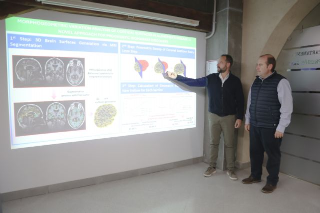 Premio al estudio de la UPCT que propone un nuevo biomarcador para la detección del Alzheimer