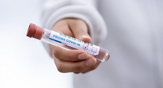 COVID-19 coronavirus en Cartagena. Casos confirmados de infección en Cartagena